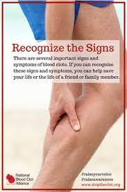 When these signs and symptoms are present, the injury should always be treated as a fracture or displacement. Blood Clot Inservice