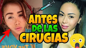 Hay un viejo refrán que dice 'la vida es un carrusel de emociones' y este, seguramente, aplica para la carrera musical de varios artistas, quienes tocaron muchas puertas antes de ser famosos. Las Fotos De Yina Calderon Y Epa Colombia Antes De Sus Cirugias Youtube