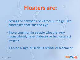 Eye Floaters Can Sometimes Occur After Cataract Surgery Even If You Haven T Been Treated For Cataracts These Nay O Eye Floaters Cure Cataract Surgery The Cure