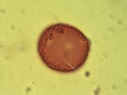 Image result for Androstachys