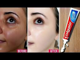 Ampuh Cara Memutihkan Kulit Wajah Dengan Pasta Gigi Youtube Vaseline Beauty Tips Pemutih Gigi Alami Pemutih Kulit