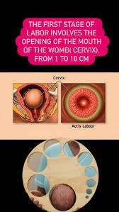 Image result for First Stage of Labor