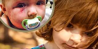 Evie McMahon is recovering after being beaten by mother