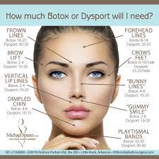 Using dysport more often than prescribed will not make it more effective and may result in serious side effects. Why Don T I Love My Botox Dysport Results Ay Magazine