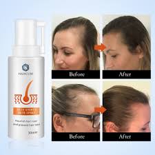 There are several different factors behind it. Haircube Hair Growth Products All Natural Spray For Hair Thickening Anti Hair Loss Treatment For Women Men Hair Growth Serum James Fashion Shop