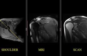 Image result for Shoulder Imaging