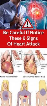 You Need To Start On A Healthy Lifestyle For A Much Healthier Heart Fresh Air And Sunlight Every Da Signs Of Heart Attack Heart Attack Coronary Artery Disease