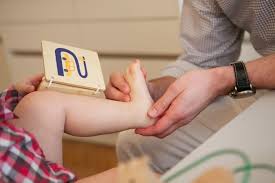 Einer sichelfußhaltung durch nutzung eines reflexes. Dr Albert Handlbauer Orthopadie Kinderfuss Kinder Erwachsene