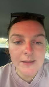 Avoiding Infections After My Eyeball Incident