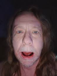 Dental Implants and Surgery Experience in Las Vegas