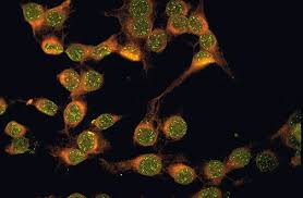 Image result for ANA Staining Pattern