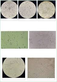 Grátis: Atlas de Urinálise - Material Claro e Objetivo em PDF para Estudo  Rápido