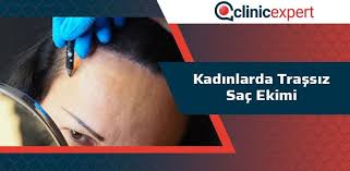 Kadinlarda Tirassiz Sac Ekimi Clinicexpert Uluslararasi Saglik Hizmetleri