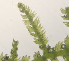 Image result for Leptonychia