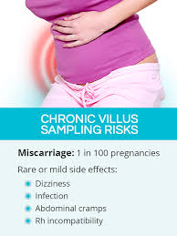 Image result for Chorionic Villus Sampling