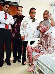 +60 4 643 3888 email: Hospital Pantai Ipoh Sedia Rawat Budak Sakit Kulit Kembara Seorang Hamba