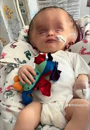 Prayers for Baby Annalise's Recovery from Brain Surgery