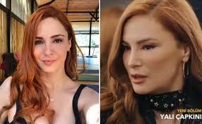 Mine Tugay plastik əməliyyat etdirib?