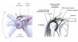 Tipo acromial de brasileiros: Estudo em escápulas humanas