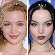 Qui sont ces stars qui auraient succombé à la bichectomie ?