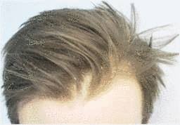 Vous voulez vous en débarrasser, voici une recette maison intraitable contre ses petits parmi les recettes de beauté fait maison qu'on vous a présenté, quel est votre préféré ? Quels Sont Les Meilleurs Remedes Anti Pellicule Tout Pratique