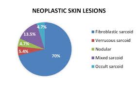 pie chart represents the percentage of different types of