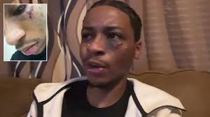 A Houston man says a night out to see his favorite reality stars ended with  him in the ER — after something was thrown from the stage and hit him in the