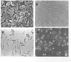 Because immature cells are larger than older red cells, infants with active erythropoiesis have elevated rdws.11 infants who have received blood it is not uncommon to see variation in shape in neonatal rbcs. A Bloody Tale Sickle Cells In Deer Nature Portfolio Ecology Evolution Community