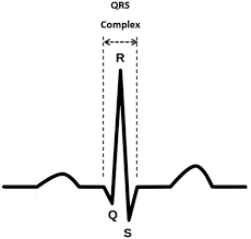 Image result for QRS Complex