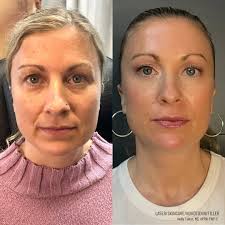 Holly Tabor, MS, APRN, FNP-C