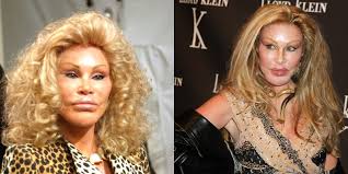 We may earn commission on some of the items you choose to buy. 11 People Who Have Taken Plastic Surgery To The Extreme