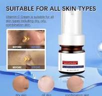 𝐖𝐡𝐢𝐭𝐞𝐧𝐢𝐧𝐠 and 𝐅𝐫𝐞𝐜𝐤𝐥𝐞 Removing Essence, 30ml Magic  𝐖𝐡𝐢𝐭𝐞𝐧𝐢𝐧𝐠 𝐒𝐩𝐨𝐭 Cream, Vitamin C 𝐁𝐥𝐞𝐦𝐢𝐬𝐡 Serum for  𝐌𝐞𝐥𝐚𝐬𝐦𝐚 𝐌𝐞𝐥𝐚𝐧𝐨𝐬𝐢𝐬 𝐀𝐜𝐧𝐞 𝐒𝐜𝐚𝐫𝐬