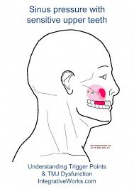 Pin On Sinus