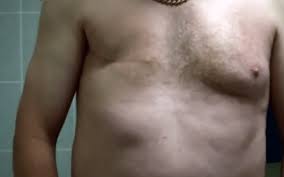 The mix of these tests gives the doctor a notion on how the cancer may possibly answer treatment. Breast Cancer Campaigns Might Be Pink But Men Get It Too Iflscience