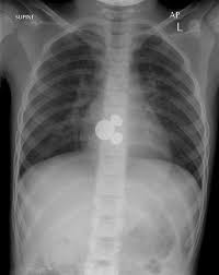 Got Change X Ray Body Radiology Technologist