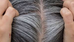 Coconut oil penetrates through the hair shaft and reduces protein loss. Top Grey Hair Treatment To Prevent White Hair From Spreading