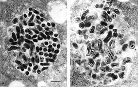 Chronic q fever develops months or years following initial q fever infection. Fiebre Q Fundacion Io