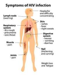Pin On Hiv