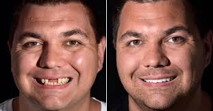 Dental Tourism Testimonials