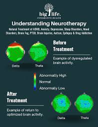 Image result for Higher Integrative Function