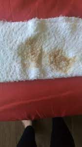 Vomito Cafe En Mi Bebe Que Solo Toma Leche Club Febrero 2019 Embarazo Y Bebes Babycenter
