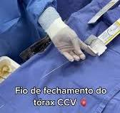 Fio de aço para fechamento do torax | TikTok