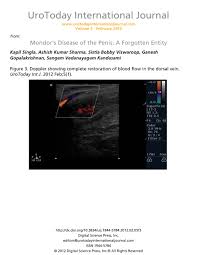 The kaohsiung journal of medical sciences. Mondor S Disease Of The Penis A Forgotten Entity