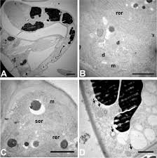 Image result for Trema sp A