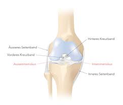 Gegebenenfalls schmerzen beim durchstrecken des beines. Verletzung Des Meniskus Bewahrte Behandlungsmethoden Klinik Pyramide