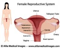 It can cause a variety of reproductive dysfunctions. Female Anatomy Labeled Diagram Anatomy Drawing Diagram