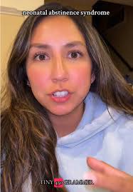 Understanding Neonatal Abstinence Syndrome in Newborns