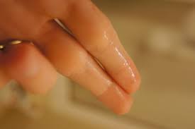 The brown discharge that sometimes you may notice after the ovulation is not even a matter to worry, but there are some now 3 days after ovulation i have white creamy discharge. Watery Cm After Ovulation Pregnant