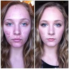 before and after makeup huge difference