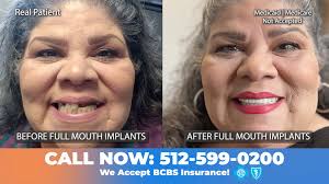 How We Change Lives With New Smiles